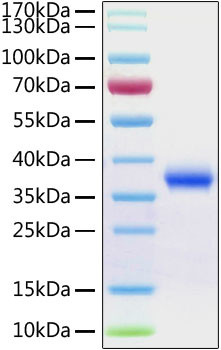 SARS-CoV-2 Spike Protein (RBD) (aa319-541), His Tag Protein