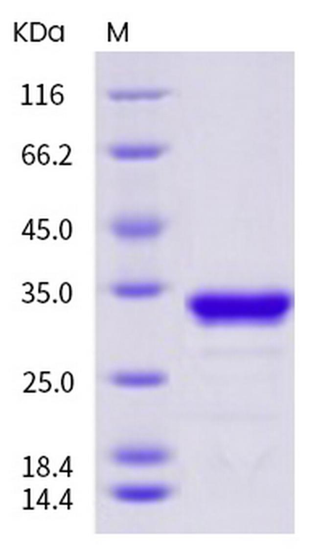 Aequorea victoria GFP His-tag Protein