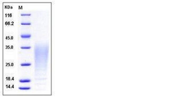 Cynomolgus IL-13 His-tag Protein