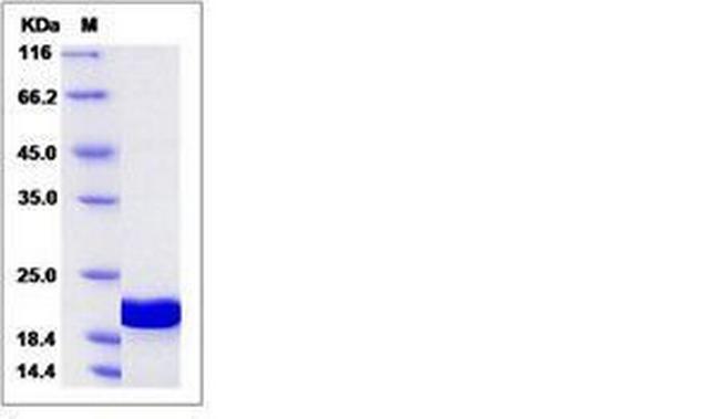 Human GABARAPL1 (ATG8) His-tag Protein
