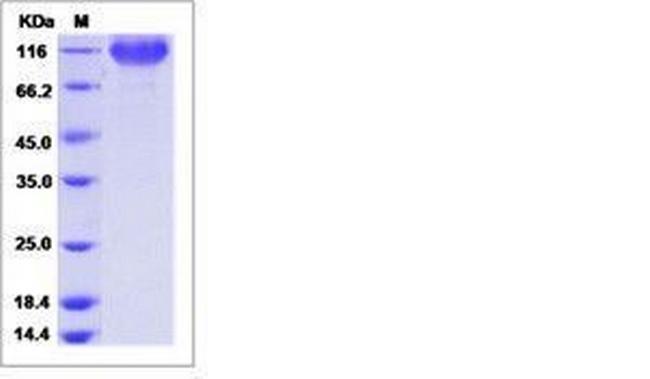 Human B7-H3 (CD276) Fc Chimera Protein
