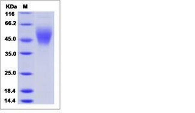 Human B7-H6 His-tag Protein