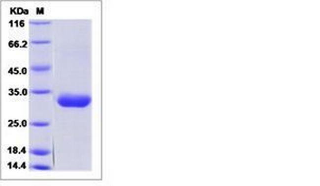 Human BTN3A2 His-tag Protein
