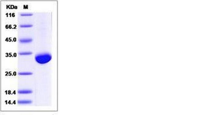 Human BTN3A3 His-tag Protein