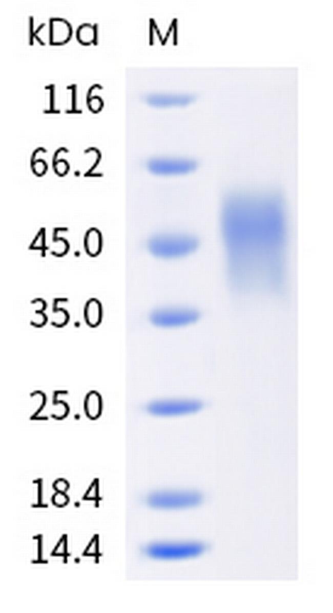 Human Fc gamma RIIIA (CD16a) (176 Val) His-tag Protein