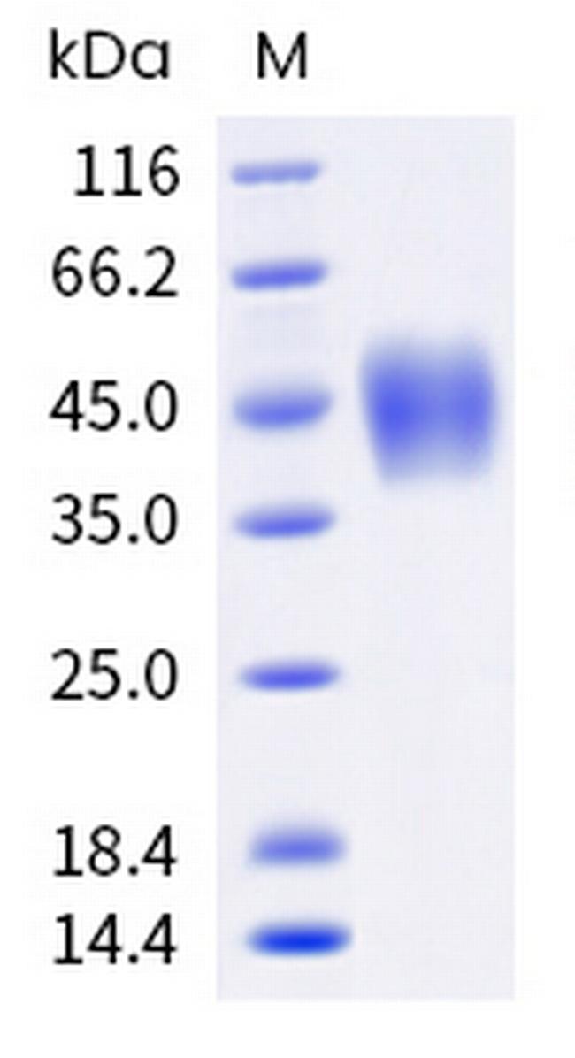 Human Fc gamma RIIIA (CD16a) (176 Val) His-tag Protein