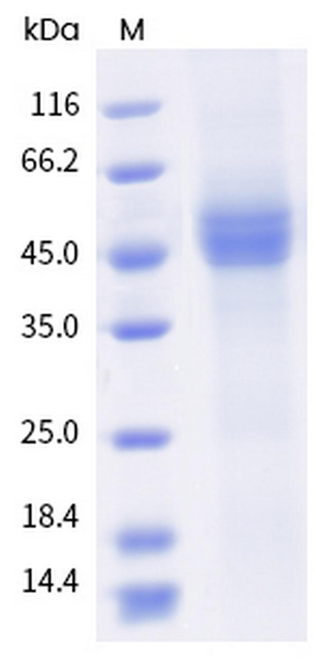 Human CD19 His-tag Protein