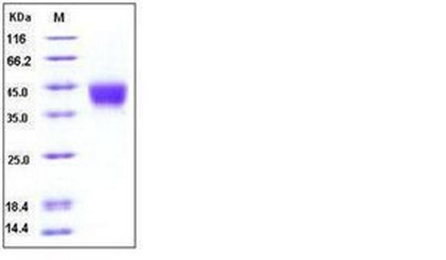 Human CD200 His-tag Protein