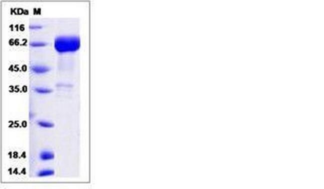 Human Siglec-3 (CD33) Fc Chimera Protein