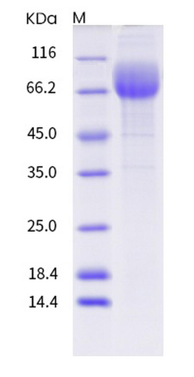 Human CD36 (SR-B3) His-tag Protein