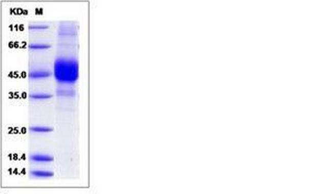 Human CD3 delta Fc Chimera Flag-tag Protein