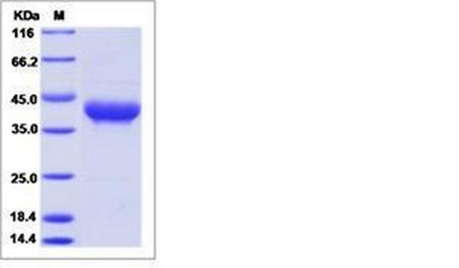 Human CD52 Fc Chimera Protein