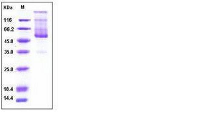 Human CD27L (TNFSF7) Fc Chimera Protein