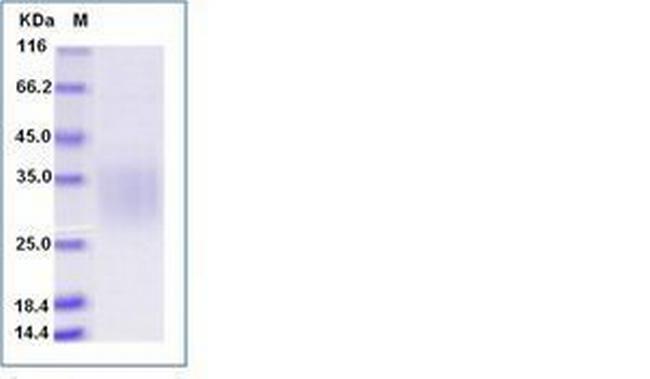 Human CD79a His-tag Protein