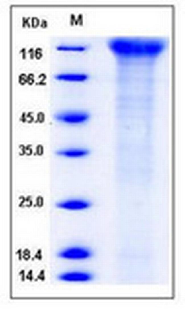 Human CD96 His-tag Protein