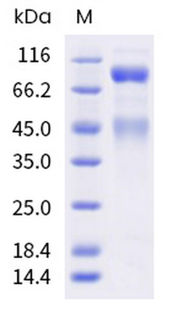 Human HGFR (c-MET) His-tag Protein