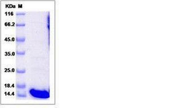 Human GABARAPL2 (GATE-16) His-tag Protein
