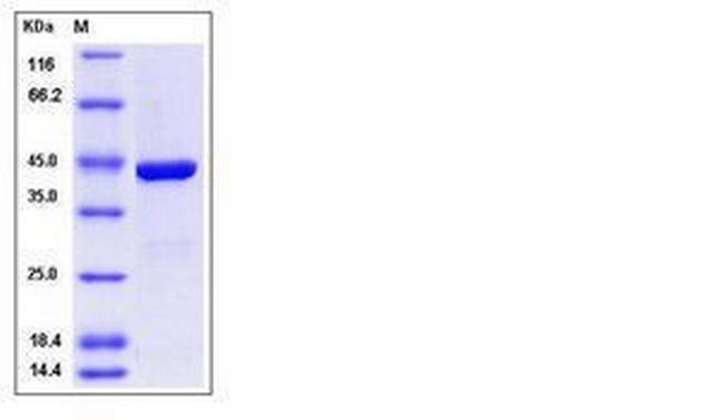 Human IDO2 His-tag Protein