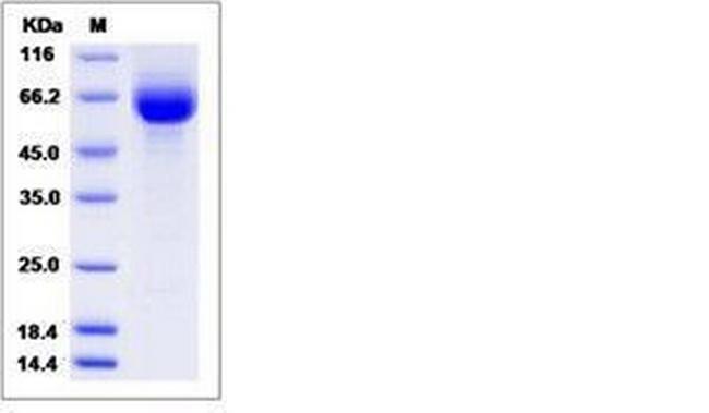 Human LILRA3 (CD85e, ILT6) His-tag Protein