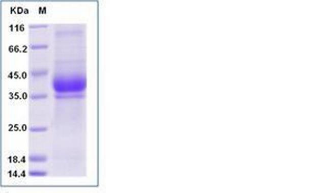 Human Kallikrein 15 His-tag Protein