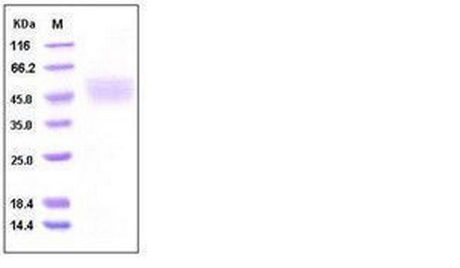 Human Kallikrein 1 His-tag Protein