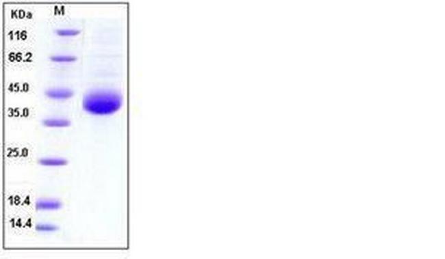 Human Kallikrein 11 His-tag Protein