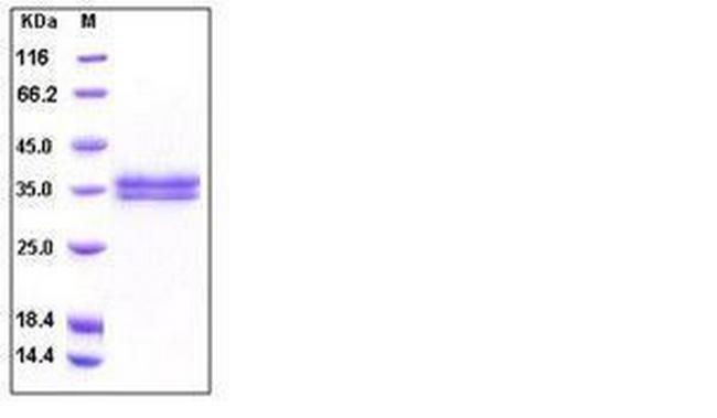 Human Kallikrein 13 His-tag Protein