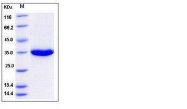 Human Kallikrein 3 His-tag Protein
