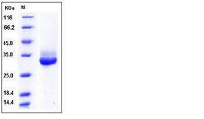 Human Kallikrein 4 His-tag Protein