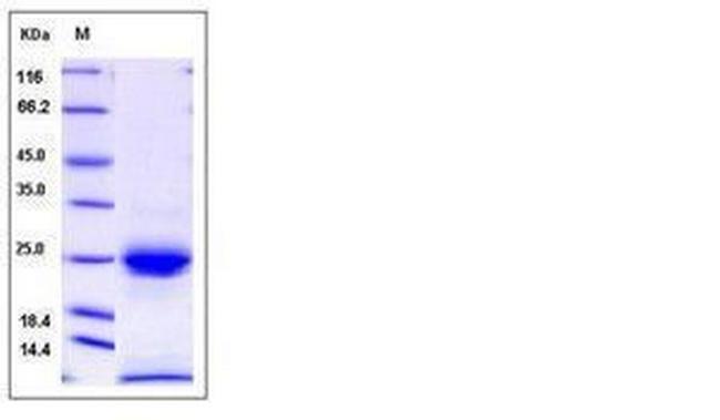 Human Kallikrein 6 His-tag Protein