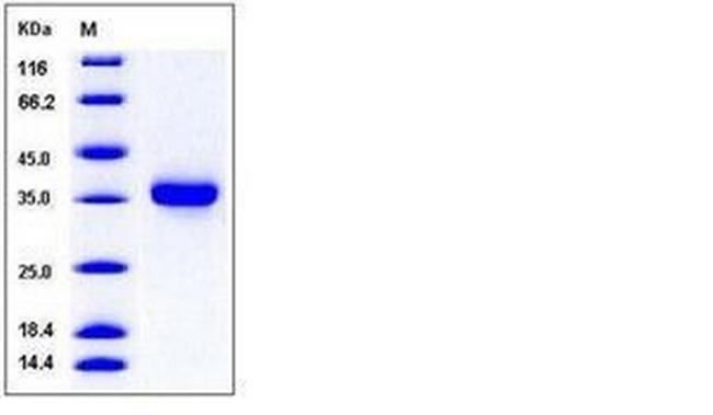 Human Kallikrein 8 His-tag Protein