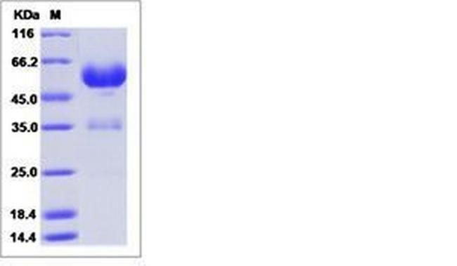 Human LAIR1 Fc Chimera Protein