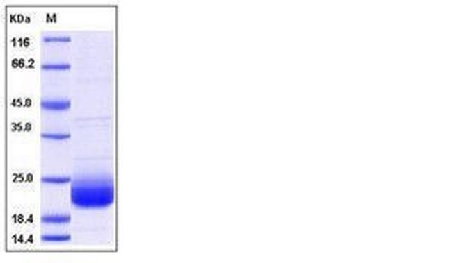 Human LAIR2 Protein