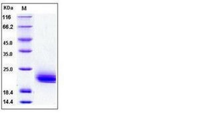 Human LAIR2 His-tag Protein