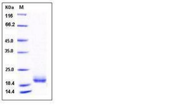 Human LAIR2 Protein