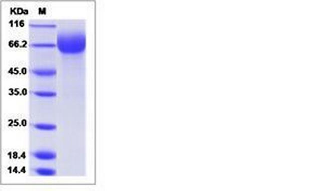Human LILRA1 (CD85i, LIR-6) His-tag Protein