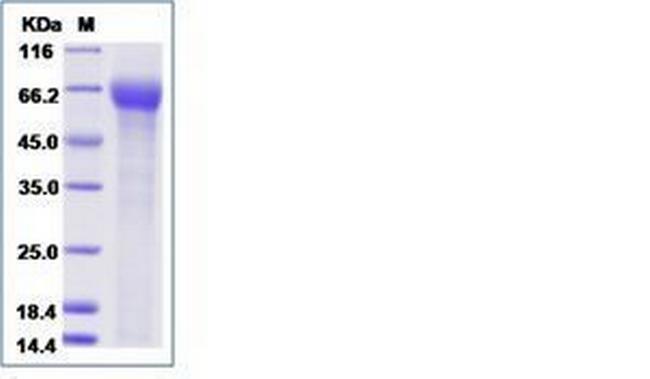 Human LILRA4 His-tag (CD85g) His-tag Protein