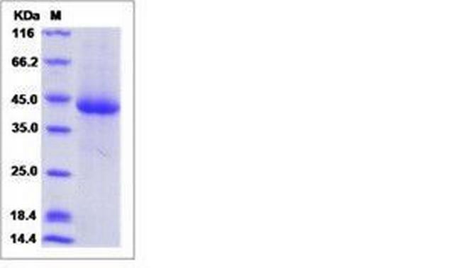 Human LILRA5 (CD85f, LIR-9) His-tag Protein