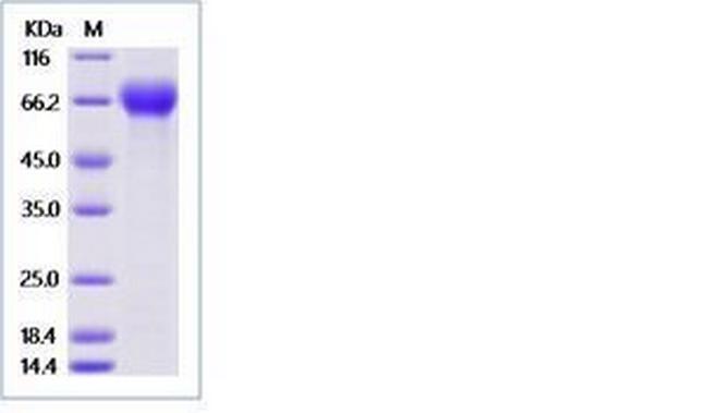 Human LILRA6 (CD85b, ILT8) His-tag Protein