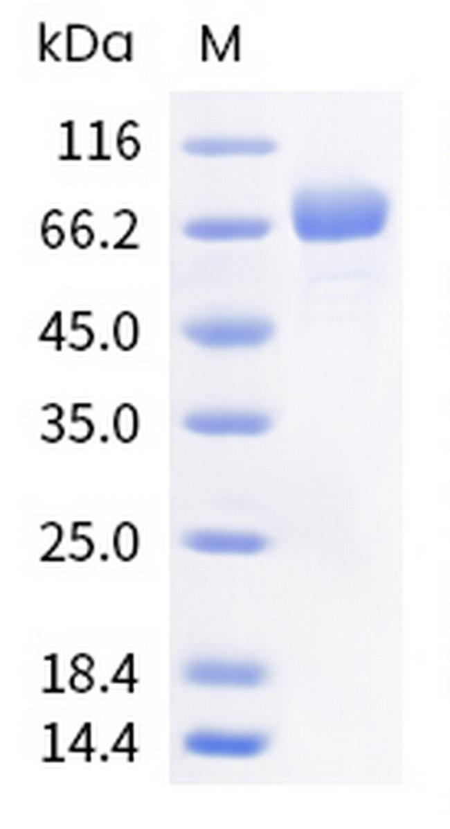 Human CD85d (ILT4) His-tag Protein