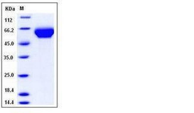 Human LILRB3 (CD85a, ILT5) His-tag Protein