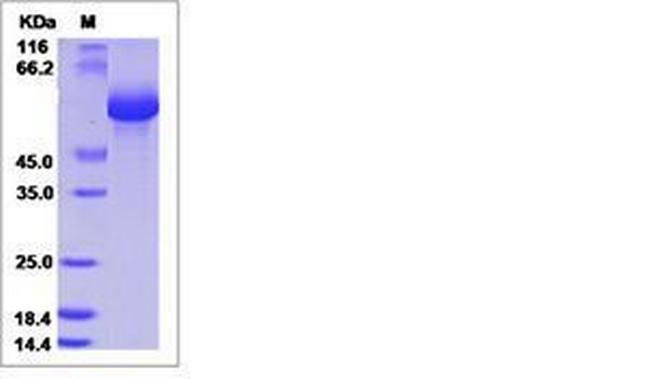 Human LILRB5 (CD85c, LIR-8) His-tag Protein