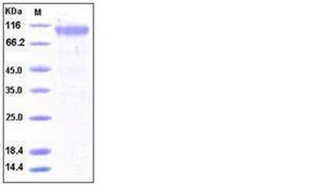 Human PDGFRA (CD140a) Protein