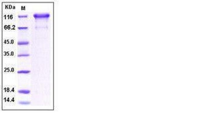 Human PDGFRA (CD140a) Fc Chimera Protein