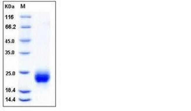 Human R-Spondin 1 (aa 1-146) His-tag Protein