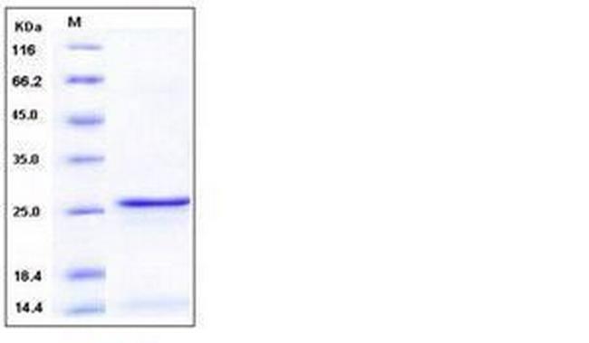 Human S100A9 Protein