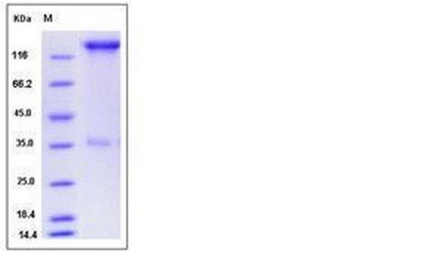 Human P-selectin (CD62P) Fc Chimera Protein