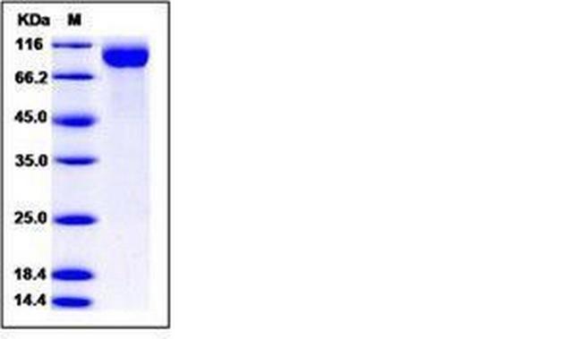 Human Siglec-2 (CD22) (aa 176-687) His-tag Protein