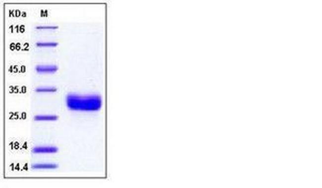 Human ULBP-1 His-tag Protein