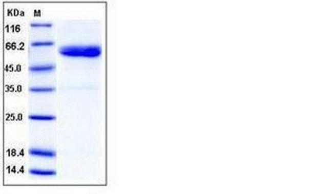 Human ULBP-1 Fc Chimera His-tag Protein